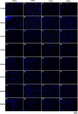The Rapid Cytological Process of Grain Determines Early Maturity in Weedy Rice